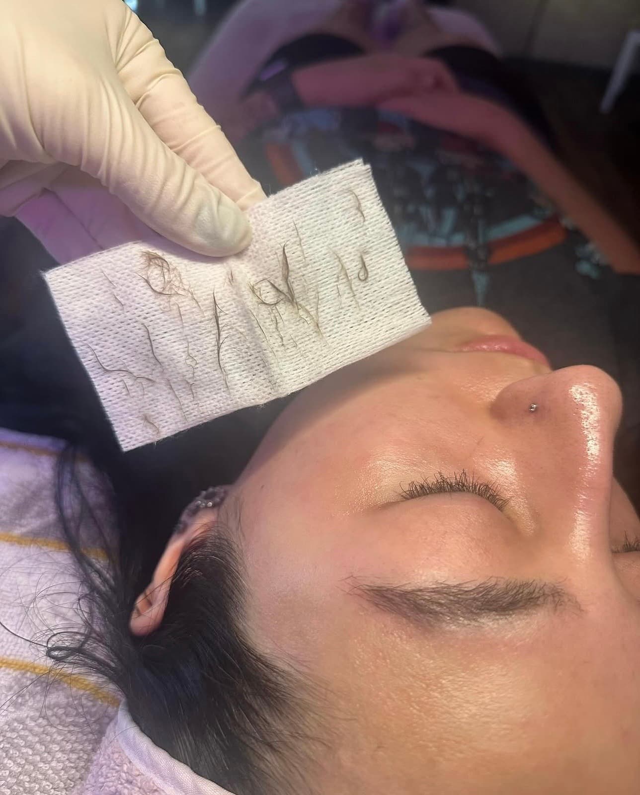 Dermaplane Facial