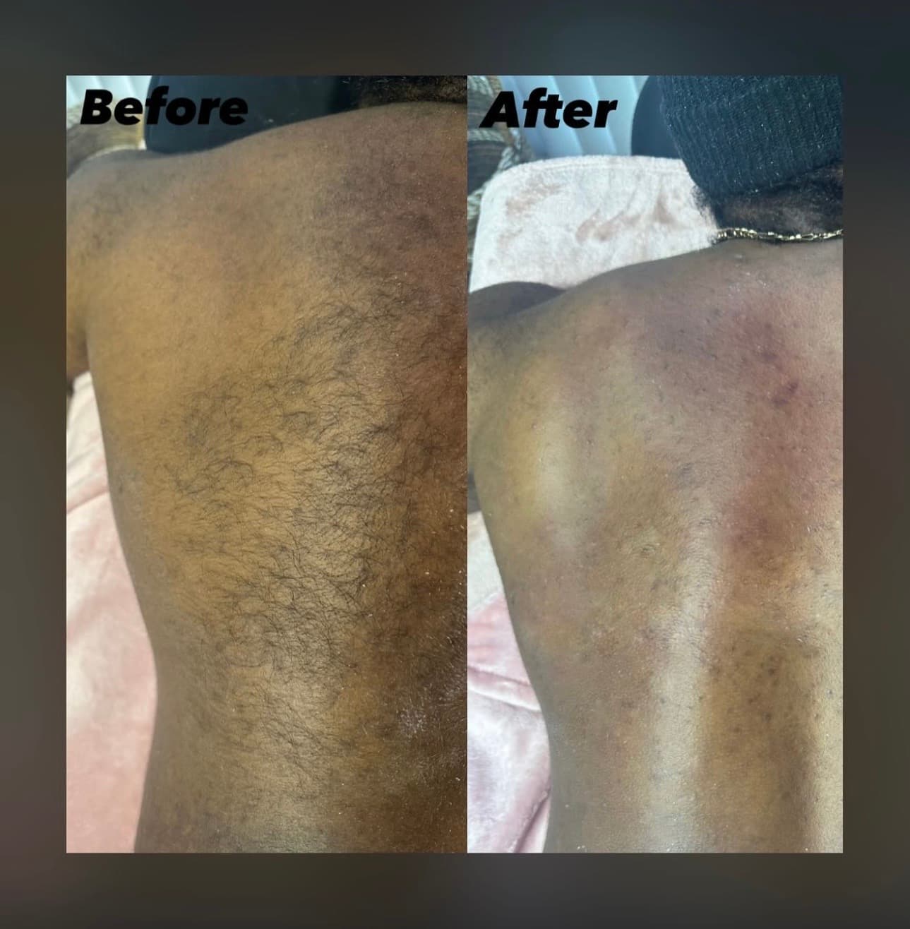 Back Wax