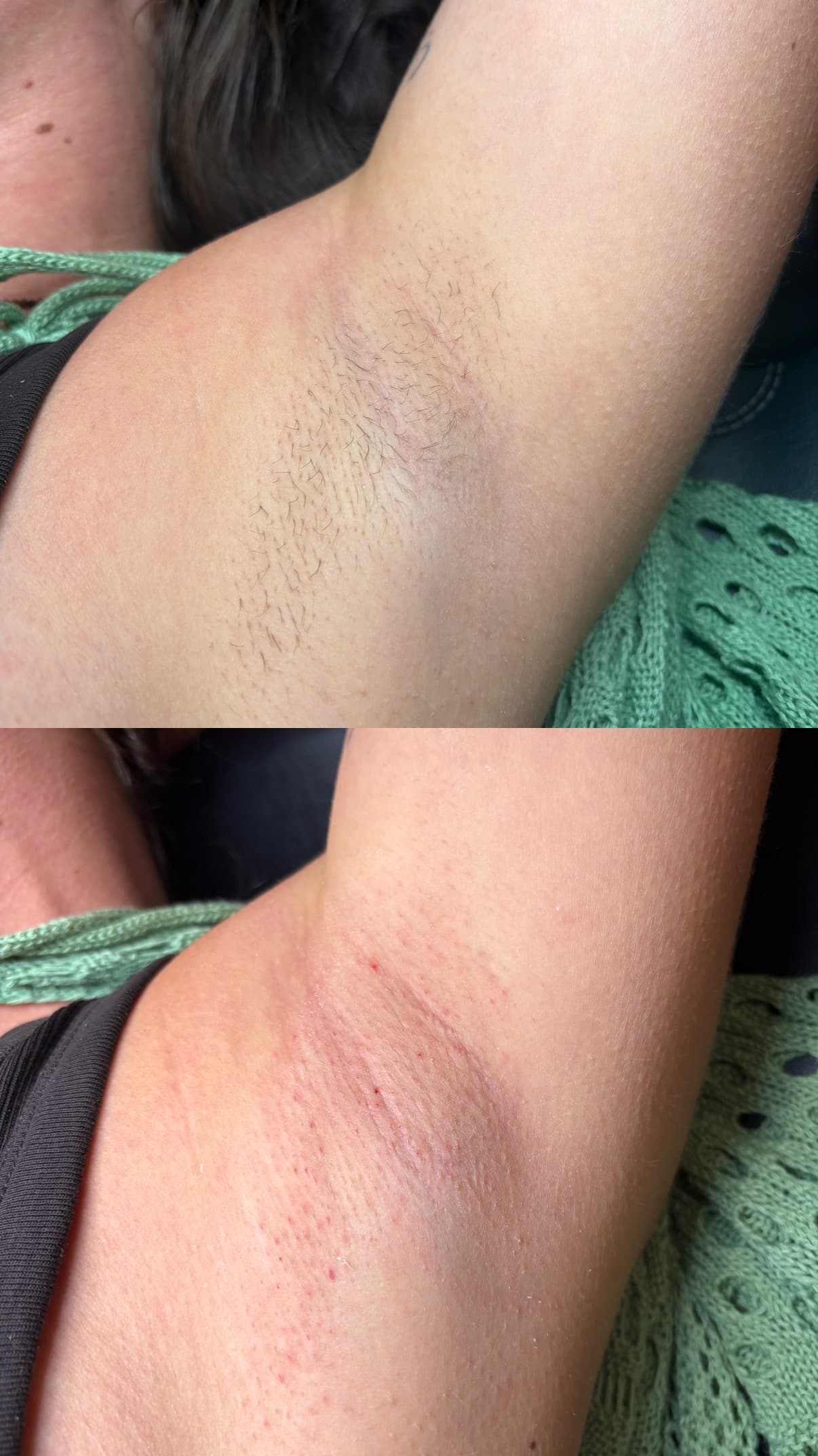 Under Arm Wax